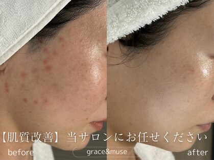 グレイス アンド ミューズ(grace&muse)の写真