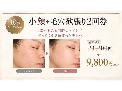 エステティックサロン ライブ井藤の写真