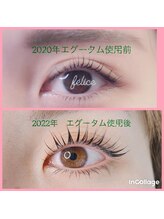 フェリーチェ(felice)/エグータム美容液