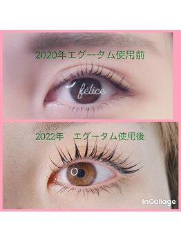 フェリーチェ(felice)/エグータム美容液