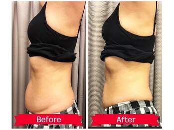 ビトタン 倉敷本店(+美to鍛)/40代からのポッコリお腹に！