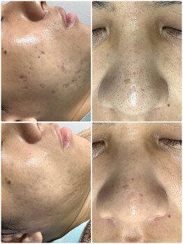 ザ ファーストサロン(The First Salon)/メンズフェイシャルも人気です