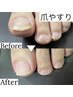 【爪整体】　爪のお手入れ＋爪やすりサポート　10本　¥4400→2980