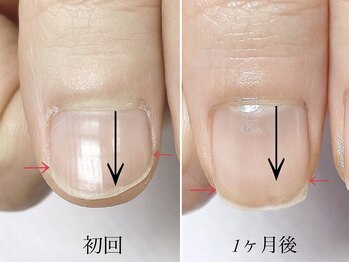 トゥインクリーネイルサロン(Twinkly Nail Salon)/【最強のネイルケア】1回お試し