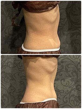 ソルエユニーク(Le seul et unique)/上半身8回の効果。綺麗なくびれ