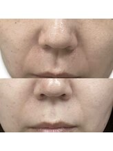 フェリス(feliz)/美白、ほうれいせんに◎[白石区]