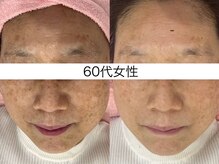 サクラ 本厚木駅前店(SAKURA)/本厚木シミケア/伊勢店シミケア