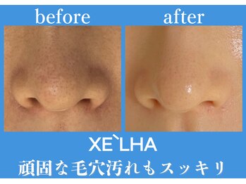 パールホワイトニングサロン 町田店/韓国美容！最新セラピール