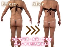 くびれ、大転子の出っ張り改善、ヒップUP効果◎