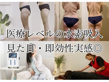 ヨサパーク サン ミナミ 国分寺(YOSA PARK SUN)