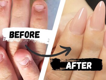 ヘブンリープラス＋ Luz湘南辻堂店の写真/【深爪・トラブル爪に強い！】初めてでも安心！深爪矯正なら、手元を隠さなくて大丈夫！メンズも大歓迎◎