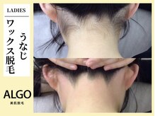 アルゴ 飯塚店(ALGO)/うなじワックス脱毛