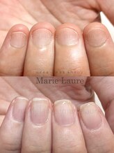 マリーロール 淀屋橋本店(Marie Laure)/自爪育成/深爪矯正/ネイルケア