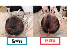 バランスアップラボ(バランスアップLAB)/★赤ちゃん整体　Before＆After3