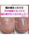 爪が綺麗になりました！