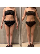 ギャラクシービューティー(galaxy beauty)/深部マッサージ