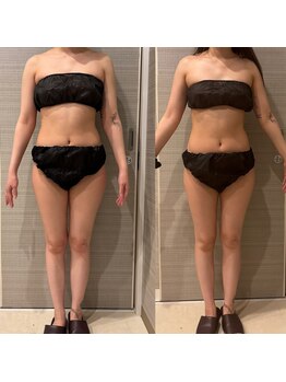 ギャラクシービューティー(galaxy beauty)/深部マッサージ