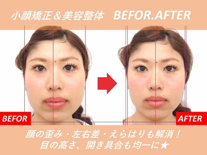 豊中吹田美容整体リジョイスの写真