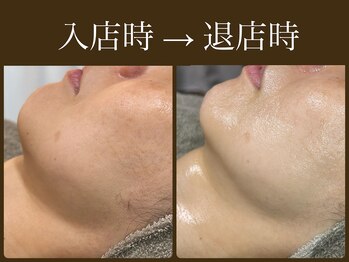 ビーエルティー(blt)/レモンボトル