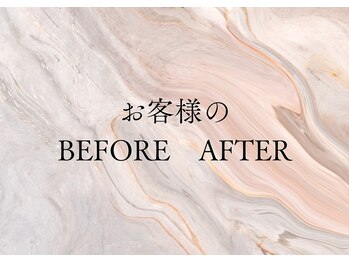 ヨサパーク サノン(YOSA PARK Sanon)/BEFORE AFTER