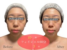 アルピナ(ALPINA)/ウルトランスフォーマー