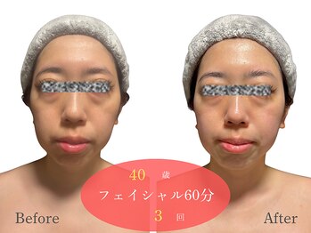 アルピナ(ALPINA)/ウルトランスフォーマー