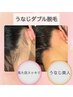 【女性】サロン人気No.2！うなじダブル脱毛　4500円