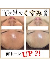 ブレリアントサロン 池袋店(brillant salon)/【施術】年齢肌トータル改善