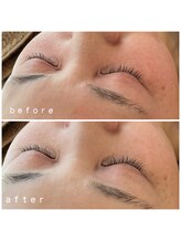 メナードフェイシャルサロン 岐阜茜部/コラックスケアパック