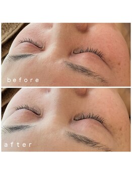 メナードフェイシャルサロン 岐阜茜部/コラックスケアパック