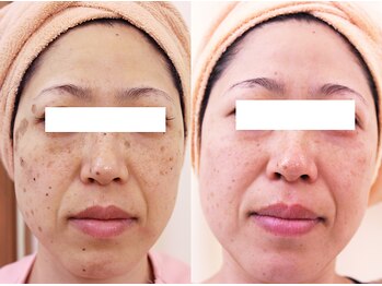 ファニービー 茨木店/50代 Before→After