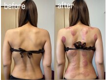 灯香庵 玉響(たまゆら)/【カッピング】before after 