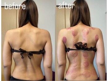 灯香庵 玉響(たまゆら)/【カッピング】before after 