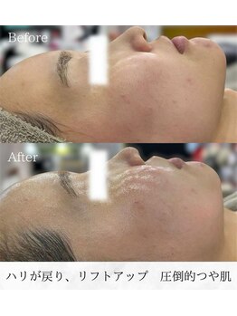 シロ(silo)/圧倒的つや肌