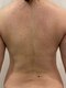 エミール(EMIIR)の写真/理想の”美ボディ”を手に入れる◎豊富な知識と丁寧なカウンセリングでとにかく結果を出したい方必見!!