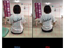 ストレチックス 近江八幡店/ストレッチ　ビフォーアフター