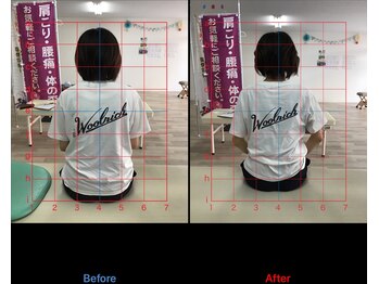 ストレチックス 近江八幡店/ストレッチ ビフォーアフター