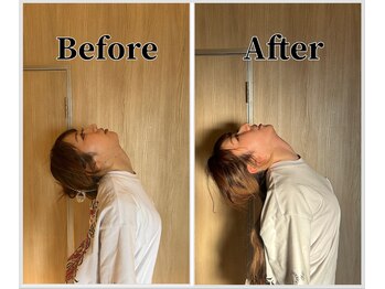 整体ラルース 中目黒(LALUZ)/20代 女性 ストレートネック改善