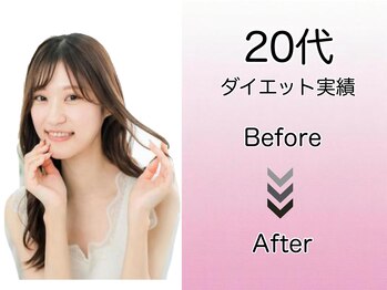 こんだ整骨院/20代ダイエット