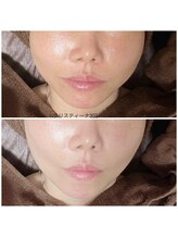 ソラ(sora)/クリスティーナ