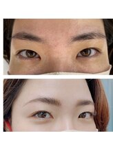 アーチ 代々木上原(ARCH)/ディープクレンジングとエクステ