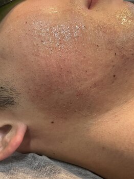 ラッシュ(RUSH)/1回目で抜ける方もいます!