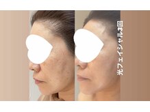 エースビューティー(Ace.Beauty)/