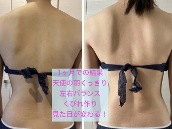 ヨサパーク ベスティ 阿佐ヶ谷(Yosa Park bestie)/ボディビフォアフ:挙式前1ヶ月