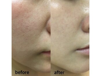 プログレス(PROGRESS)