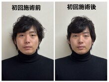 トータルバランス整体院 &nbsp;オレンジ(ORANGE)/小顔矯正/とにかく小顔にしたい