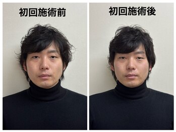 トータルバランス整体院 &nbsp;オレンジ(ORANGE)/小顔矯正/とにかく小顔にしたい