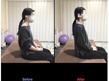 鹿児島整体院/猫背/首こり/鹿児島/整体