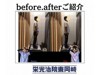 栄光治院 整体院東岡崎/【岡崎/東岡崎/整体/腰痛