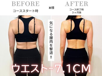 スリービーダイエット 町田店/ダイエットビフォーアフター
